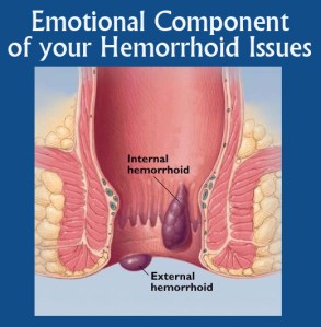 HEMORROID